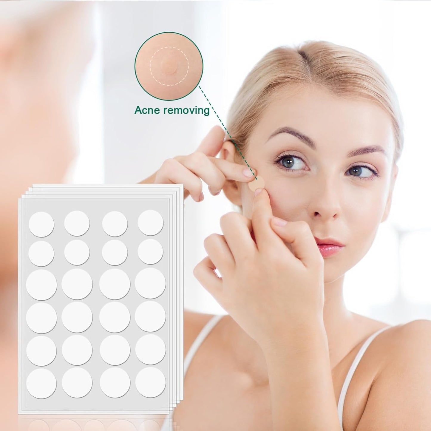 Acne Pimple Patches | 96 Patches
