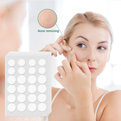 Acne Pimple Patches | 96 Patches
